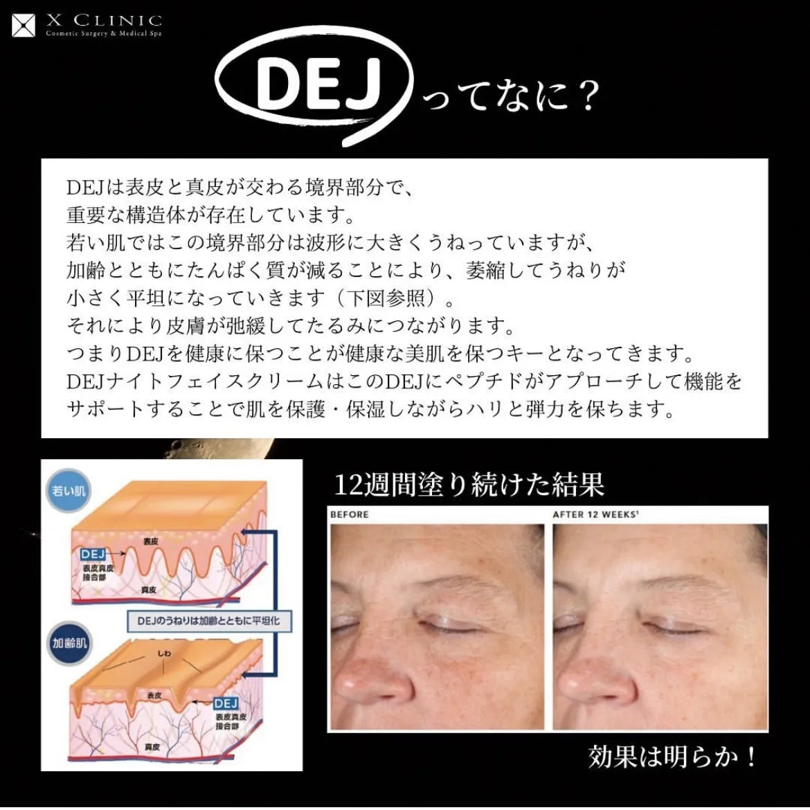 リビジョン_DEJナイトフェイスクリーム成分