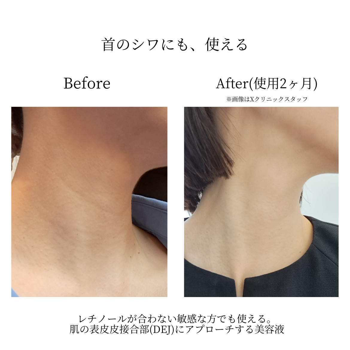 ゼオスキンヘルス ファーミングセラム 通販 - X CLINIC online ゼオスキンヘルス ファーミングセラム 通販 - X CLINIC online