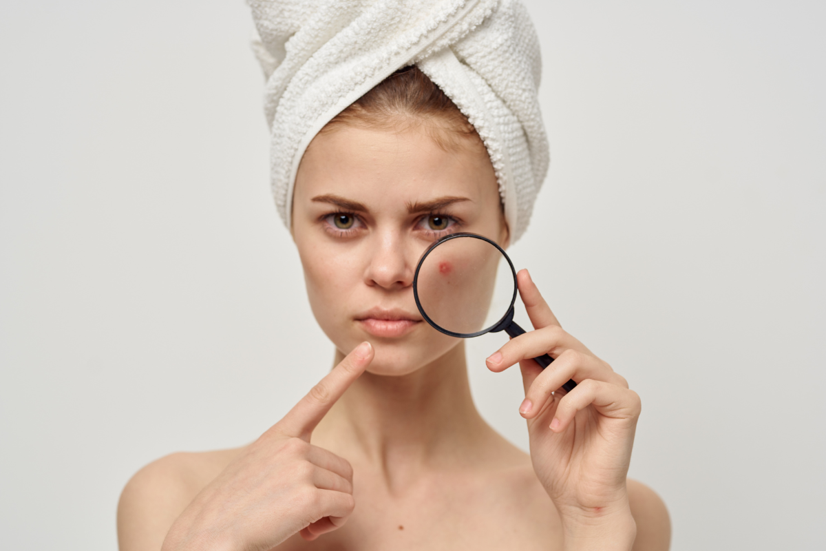 シミを取るには？化粧品での対策とおすすめドクターズコスメ10選