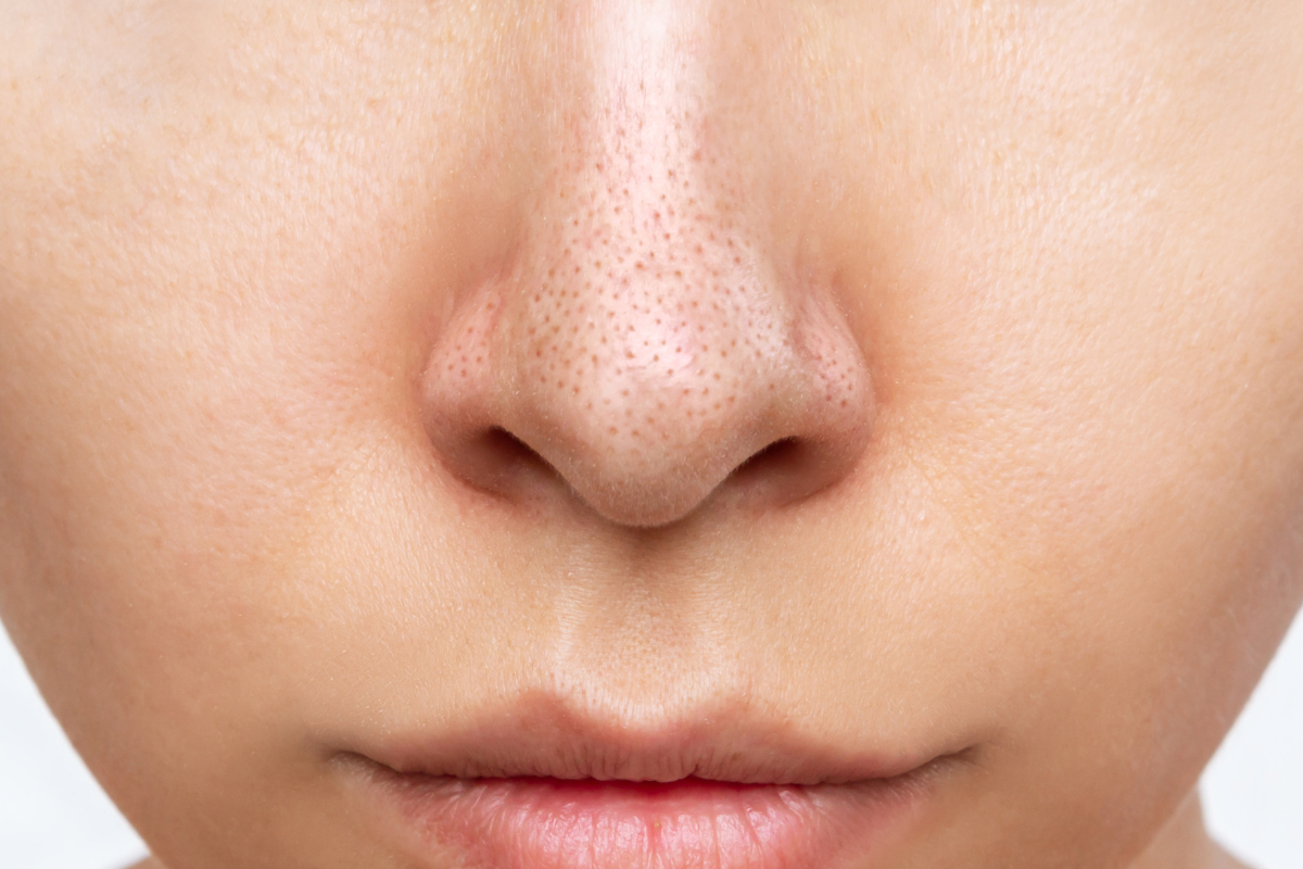 毛穴が目立つ原因とは？症状別の理由や毛穴の目立ち対策を徹底解説